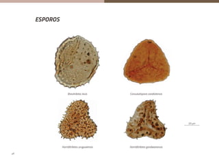 ESPOROS
20 μm
Cirratriradites sp. Cristatisporites morungavensis
20 μm
Brevitriletes levis Convolutispora candiotensis
Horriditriletes uruguaiensis Horriditriletes gondwanensis
20 μm
20 μm
Brevitriletes levis Convolutispora candiotensis
Horriditriletes uruguaiensis Horriditriletes gondwanensis
20 μm
Cirratriradites sp. Cristatisporites morungavensis
20 μm
Brevitriletes levis Convolutispora candiotensis
Horriditriletes uruguaiensis Horriditriletes gondwanensis
20 μm
Cirratriradites sp. Cristatisporites morungavensis
20 μm
Brevitriletes levis Convolutispora candiotensis
Horriditriletes uruguaiensis Horriditriletes gondwanensis
Brevitriletes levis
Horriditriletes uruguaiensis Horriditriletes gondwanensis
Convulutispora candiotensis
20 µm
48
 