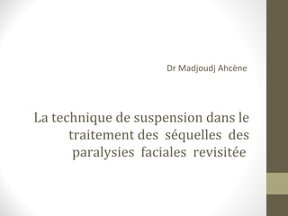 La technique de suspension dans le
traitement des séquelles des
paralysies faciales revisitée
Dr Madjoudj Ahcène
 