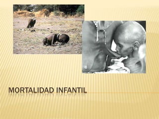 MORTALIDAD INFANTIL
 