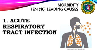 MORBIDITY
TEN (10) LEADING CAUSES
1. ACUTE
RESPIRATORY
TRACT INFECTION
 