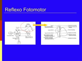 Reflexo Fotomotor
 