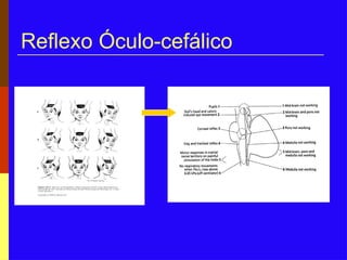 Reflexo Óculo-cefálico
 