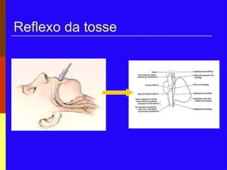Reflexo da tosse
 