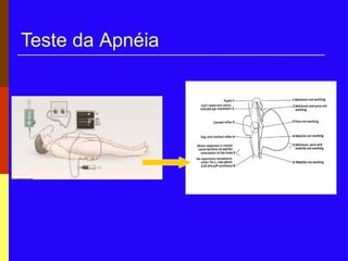 Teste da Apnéia
 