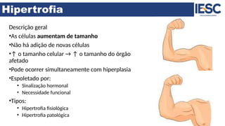 Hipertrofia
Descrição geral
•As células aumentam de tamanho
•Não há adição de novas células
•↑ o tamanho celular → ↑ o tamanho do órgão
afetado
•Pode ocorrer simultaneamente com hiperplasia
•Espoletado por:
• Sinalização hormonal
• Necessidade funcional
•Tipos:
• Hipertrofia fisiológica
• Hipertrofia patológica
 