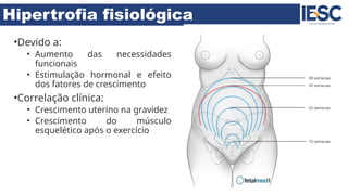 Hipertrofia fisiológica
•Devido a:
• Aumento das necessidades
funcionais
• Estimulação hormonal e efeito
dos fatores de crescimento
•Correlação clínica:
• Crescimento uterino na gravidez
• Crescimento do músculo
esquelético após o exercício
 