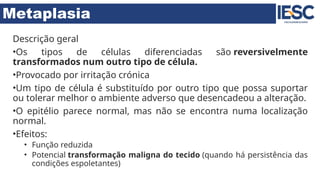 Metaplasia
Descrição geral
•Os tipos de células diferenciadas são reversivelmente
transformados num outro tipo de célula.
•Provocado por irritação crónica
•Um tipo de célula é substituído por outro tipo que possa suportar
ou tolerar melhor o ambiente adverso que desencadeou a alteração.
•O epitélio parece normal, mas não se encontra numa localização
normal.
•Efeitos:
• Função reduzida
• Potencial transformação maligna do tecido (quando há persistência das
condições espoletantes)
 