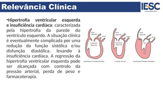 Relevância Clínica
•Hipertrofia ventricular esquerda
e insuficiência cardíaca: caracterizada
pela hipertrofia da parede do
ventrículo esquerdo. A situação clínica
é eventualmente complicada por uma
redução da função sistólica e/ou
disfunção diastólica, levando à
insuficiência cardíaca. A regressão da
hipertrofia ventricular esquerda pode
ser alcançada com controlo da
pressão arterial, perda de peso e
farmacoterapia.
 
