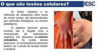 O que são lesões celulares?
As lesões celulares e os
estímulos de adaptação, bem como
de morte celular, são desencadeados
por estímulos fisiológicos, ou mesmo
patológicos.
O objetivo primário desses
eventos são o resgate e/ou a
manutenção da homeostasia
orgânica, em situações de estresse
metabólico. Às custas desses
processos, as consequências possíveis
podem ser a perda de função celular
e tecidual.
 