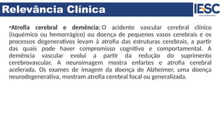 Relevância Clínica
•Atrofia cerebral e demência: O acidente vascular cerebral clínico
(isquémico ou hemorrágico) ou doença de pequenos vasos cerebrais e os
processos degenerativos levam à atrofia das estruturas cerebrais, a partir
das quais pode haver compromisso cognitivo e comportamental. A
demência vascular evolui a partir da redução do suprimento
cerebrovascular. A neuroimagem mostra enfartes e atrofia cerebral
acelerada. Os exames de imagem da doença de Alzheimer, uma doença
neurodegenerativa, mostram atrofia cerebral focal ou generalizada.
 