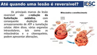 Até quando uma lesão é reversível?
Os principais marcos da lesão
reversível são a redução da
fosforilação oxidativa, com
consequente depleção do
armazenamento de ATP e tumefação
celular. Além disso, várias organelas
intracelulares, tais como as
mitocôndrias e o citoesqueleto,
podem apresentar alterações.
 