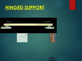 HINGED SUPPORT
KNEE
 