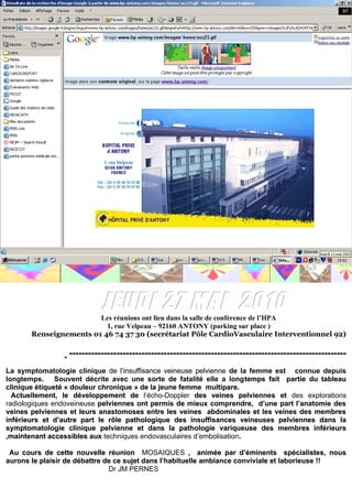 21H 1
    10         - Dr M. DADON :
Echodoppler
des points de          fuite      veineux



21 H30          - Dr O. SERRES- COUSINE                          :
Embolisation des varices pelviennes dans les                                 algies
pelviennes profondes et les points de                                fuite     veine ux
pelviens



                            INVITATION

            SOIREES « MOSAÏQUES »
      DE L’HOPITAL PRIVE D’ANTONY


                           JEUDI 27 MAI 2010
                        Les réunions ont lieu dans la salle de conférence de l’HPA
                          1, rue Velpeau – 92160 ANTONY (parking sur place )
       Renseignements 01 46 74 37 30 (secrétariat Pôle CardioVasculaire Interventionnel 92)

                 ----------------------------------------------------------------------------------------
La symptomatologie clinique de l’insuffisance veineuse pelvienne de la femme est connue depuis
longtemps. Souvent décrite avec une sorte de fatalité elle a longtemps fait partie du tableau
                                                                       temps
clinique étiqueté « douleur chronique » de la jeune femme multipare.
  Actuellement, le développement de l’écho-Doppler des veines pelviennes et des explorations
radiologiques endoveineuse pelviennes ont permis de mieux comprendre, d’une part l’anatomie des
veines pelviennes et leurs anastomoses entre les veines abdominales et les veines des membres
inférieurs et d’autre part le rôle pathologique des insuffisances veineuses pelviennes dans la
symptomatologie clinique pelvienne et dans la pathologie variqueuse des membres inférieurs
,maintenant accessibles aux techniques endovasculaires d’embolisation.
                                                                     .

 Au cours de cette nouvelle réunion MOSAIQUES , animée par d’éminents spécialistes, nous
aurons le plaisir de débattre de ce sujet dans l’habituelle ambiance conviviale et laborieuse !!
                               Dr JM PERNES
 