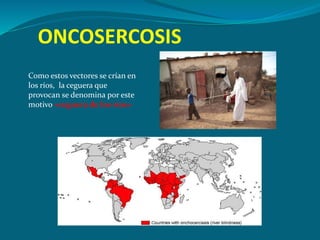 ONCOSERCOSIS
Como estos vectores se crían en
los ríos, la ceguera que
provocan se denomina por este
motivo «ceguera de los ríos»
 
