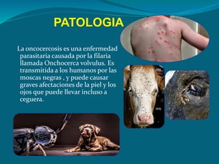 PATOLOGIA
La oncocercosis es una enfermedad
parasitaria causada por la filaria
llamada Onchocerca volvulus. Es
transmitida a los humanos por las
moscas negras , y puede causar
graves afectaciones de la piel y los
ojos que puede llevar incluso a
ceguera.
 