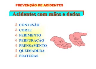 Acidentes com mãos e dedos
 CONTUSÃO
 CORTE
 FERIMENTO
 PERFURAÇÃO
 PRENSAMENTO
 QUEIMADURA
 FRATURAS
PREVENÇÃO DE ACIDENTES
 