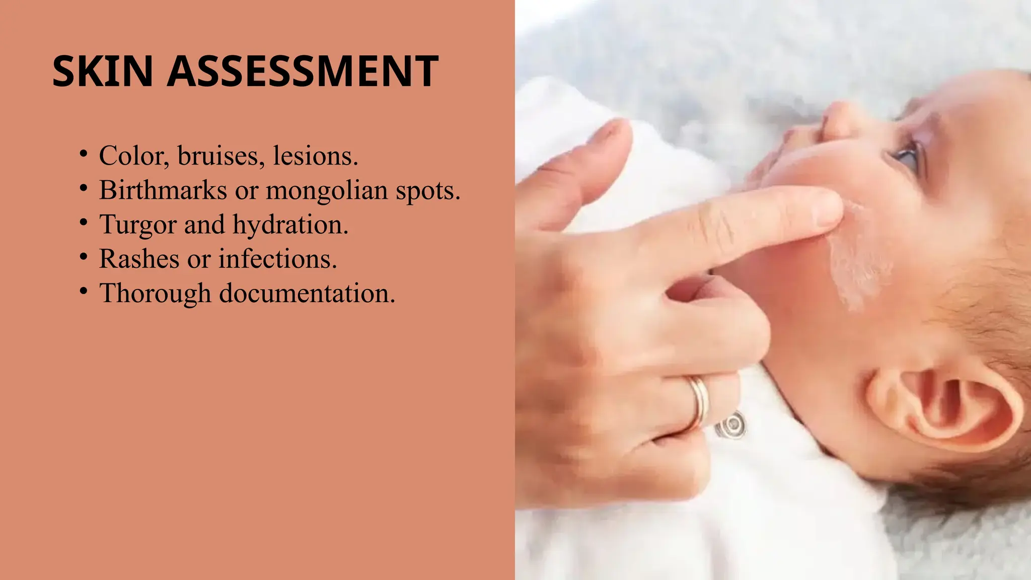 Documenting A Rash Paediatric Assessment for nurses by Daud ghouri(MSN) | PPTX
