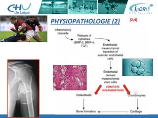 PHYSIOPATHOLOGIE	
  (2)	
  
CONTEXTE	
  
INFLAMMATOIRE	
  
(2,4)	
  
 