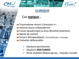 Titre	
  de	
  la	
  page	
  1	
  
Lorem	
  ipsum	
  dolor	
  sit	
  amet,	
  consectetur	
  adipiscing	
  elit,	
  sed	
  do	
  eiusmod	
  tempor	
  incididunt	
  ut	
  
labore	
  et	
  dolore	
  magna	
  aliqua.	
  Ut	
  enim	
  ad	
  minim	
  veniam,	
  quis	
  nostrud	
  exercita:on	
  ullamco	
  laboris	
  
nisi	
  ut	
  aliquip	
  ex	
  ea	
  commodo	
  consequat.	
  Duis	
  aute	
  irure	
  dolor	
  in	
  reprehenderit	
  in	
  voluptate	
  velit	
  esse	
  
cillum	
  dolore	
  eu	
  fugiat	
  nulla	
  pariatur.	
  Excepteur	
  sint	
  occaecat	
  cupidatat	
  non	
  proident,	
  sunt	
  in	
  culpa	
  qui	
  
oﬃcia	
  deserunt	
  mollit	
  anim	
  id	
  est	
  laborum.	
  »	
  
	
  
Lorem	
  ipsum	
  dolor	
  sit	
  amet,	
  consectetur	
  adipiscing	
  elit,	
  sed	
  do	
  eiusmod	
  tempor	
  incididunt	
  ut	
  labore	
  et	
  
dolore	
  magna	
  aliqua.	
  Ut	
  enim	
  ad	
  minim	
  veniam,	
  quis	
  nostrud	
  exercita:on	
  ullamco	
  laboris	
  nisi	
  ut	
  
aliquip	
  ex	
  ea	
  commodo	
  consequat.	
  Duis	
  aute	
  irure	
  dolor	
  in	
  reprehenderit	
  in	
  voluptate	
  velit	
  esse	
  cillum	
  
dolore	
  eu	
  fugiat	
  nulla	
  pariatur.	
  Excepteur	
  sint	
  occaecat	
  cupidatat	
  non	
  proident,	
  sunt	
  in	
  culpa	
  qui	
  oﬃcia	
  
deserunt	
  mollit	
  anim	
  id	
  est	
  laborum.	
  »	
  
	
  
Lorem	
  ipsum	
  dolor	
  sit	
  amet,	
  consectetur	
  adipiscing	
  elit,	
  sed	
  do	
  eiusmod	
  tempor	
  incididunt	
  ut	
  labore	
  et	
  
dolore	
  magna	
  aliqua.	
  Ut	
  enim	
  ad	
  minim	
  veniam,	
  quis	
  nostrud	
  exercita:on	
  ullamco	
  laboris	
  nisi	
  ut	
  
aliquip	
  ex	
  ea	
  commodo	
  consequat.	
  Duis	
  aute	
  irure	
  dolor	
  in	
  reprehenderit	
  in	
  voluptate	
  velit	
  esse	
  cillum	
  
dolore	
  eu	
  fugiat	
  nulla	
  pariatur.	
  Excepteur	
  sint	
  occaecat	
  cupidatat	
  non	
  proident,	
  sunt	
  in	
  culpa	
  qui	
  oﬃcia	
  
deserunt	
  mollit	
  anim	
  id	
  est	
  laborum."	
  
CLINIQUE	
  
	
  	
  	
  	
  	
  	
  	
  Cas	
  typique…	
  
 	
  Trauma:sme	
  récent:	
  Contusion	
  ++	
  
 	
  Homme	
  jeune	
  mélanoderme	
  
 	
  Cuisse	
  (quadriceps)	
  ou	
  bras	
  (brachial	
  antérieur)	
  
 	
  Sports	
  de	
  contact	
  
 	
  Erreurs	
  thérapeu:ques:	
  Thermothérapie	
  –	
  massages	
  
 	
  Evolu:on	
  défavorable:	
  	
  
ü  	
  Douleurs	
  persistantes	
  
ü  	
  Douleurs	
  NOCTURNES	
  
ü  	
  Perte	
  mobilité	
  (ﬂexion	
  genou	
  -­‐	
  myosite	
  crurale)	
  
 