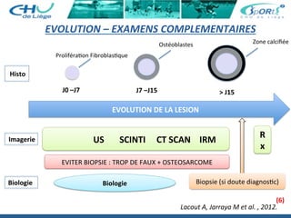 EVOLUTION	
  DE	
  LA	
  LESION	
  
J0	
  –J7	
   J7	
  –J15	
   >	
  J15	
  
	
  	
  	
  	
  	
  	
  	
  	
  	
  	
  	
  	
  	
  	
  	
  	
  	
  US	
  	
  	
  	
  	
  	
  	
  SCINTI	
  	
  	
  	
  	
  CT	
  SCAN	
  	
  	
  	
  IRM	
  	
  	
  	
  
R
x	
  
EVITER	
  BIOPSIE	
  :	
  TROP	
  DE	
  FAUX	
  +	
  OSTEOSARCOME	
  
Proliféra:on	
  Fibroblas:que	
  	
  	
  
Ostéoblastes	
  	
  	
   Zone	
  calciﬁée	
  	
  
Biopsie	
  (si	
  doute	
  diagnos:c)	
  
Histo	
  
Imagerie	
  
Biologie	
  
EVOLUTION	
  –	
  EXAMENS	
  COMPLEMENTAIRES	
  	
  
Biologie	
  
Lacout	
  A,	
  Jarraya	
  M	
  et	
  al.	
  ,	
  2012.	
  	
  
(6)	
  
 