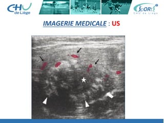IMAGERIE	
  MEDICALE	
  :	
  US	
  
 