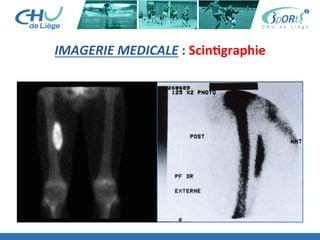 IMAGERIE	
  MEDICALE	
  :	
  ScinBgraphie	
  	
  
 