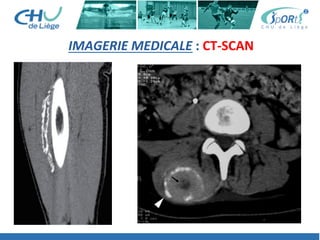 IMAGERIE	
  MEDICALE	
  :	
  CT-­‐SCAN	
  	
  
 