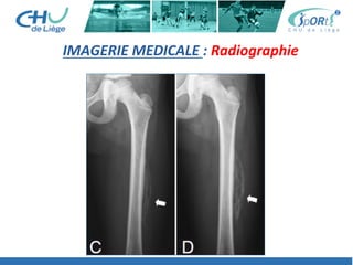 IMAGERIE	
  MEDICALE	
  :	
  Radiographie	
  
 