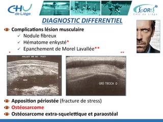 DIAGNOSTIC	
  DIFFERENTIEL	
  
 	
  ComplicaBons	
  lésion	
  musculaire	
  
ü  Nodule	
  ﬁbreux	
  
ü  Hématome	
  enkysté*	
  
ü  Epanchement	
  de	
  Morel	
  Lavallée**	
  
 	
  ApposiBon	
  périostée	
  (fracture	
  de	
  stress)	
  	
  
 	
  Ostéosarcome	
  
 	
  Ostéosarcome	
  extra-­‐squelekque	
  et	
  paraostéal	
  
* **	
  
 