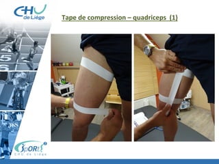 Tape	
  de	
  compression	
  –	
  quadriceps	
  	
  (1)	
  
 