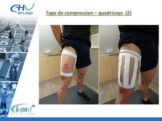 Tape	
  de	
  compression	
  –	
  quadriceps	
  	
  (2)	
  
 
