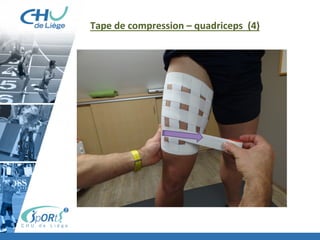 Tape	
  de	
  compression	
  –	
  quadriceps	
  	
  (4)	
  
 