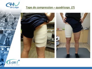 Tape	
  de	
  compression	
  –	
  quadriceps	
  	
  (7)	
  
 