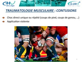 5	
  
TRAUMATOLOGIE	
  MUSCULAIRE	
  :	
  CONTUSIONS	
  
  Choc	
  direct	
  unique	
  ou	
  répété	
  (coups	
  de	
  pied,	
  coups	
  de	
  genou,	
  …)	
  
  Applica:on	
  violente	
  	
  
 