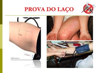 PROVA DO LAÇO
 