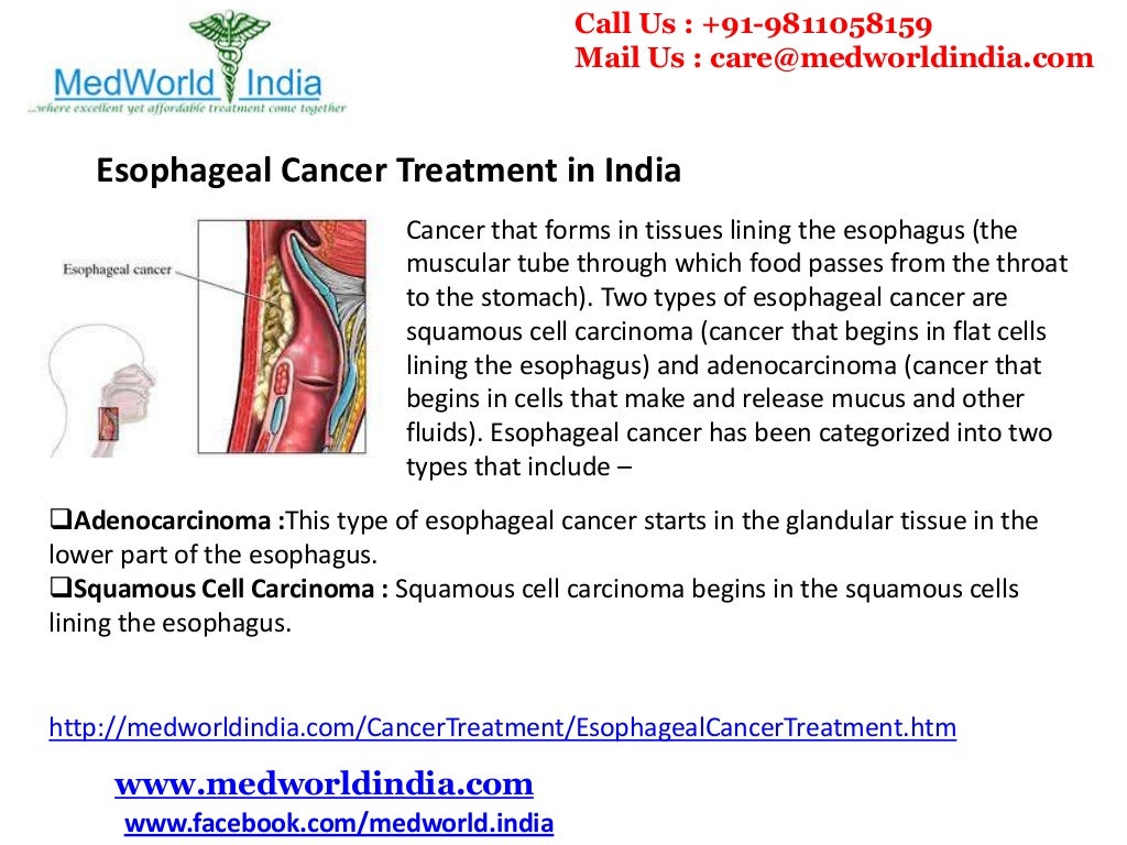 Esophageal Cancer Treatment in India Best Cancer