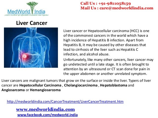 Most Advanced Liver Cancer Care and Treatment in India