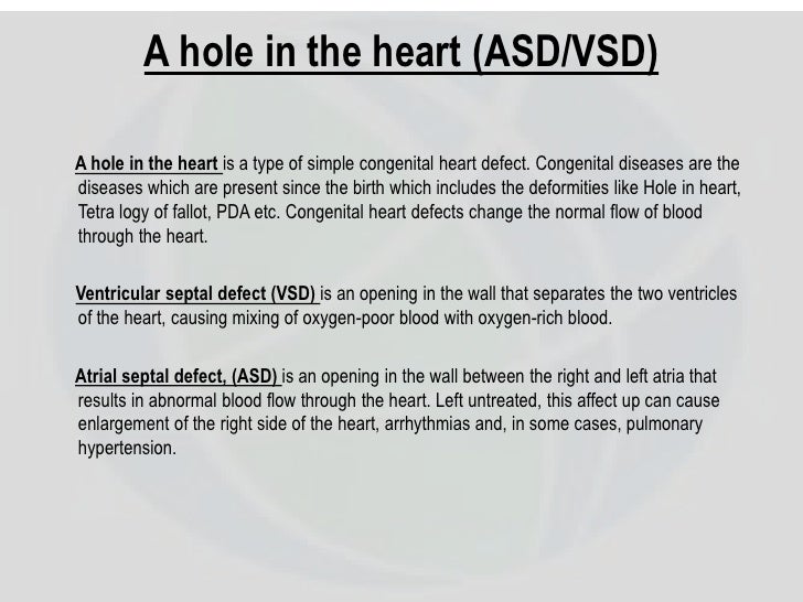 heart holes treatment passmaker heart holes treatment passmaker