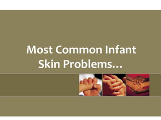 Most Common Infant
Skin Problems…
 