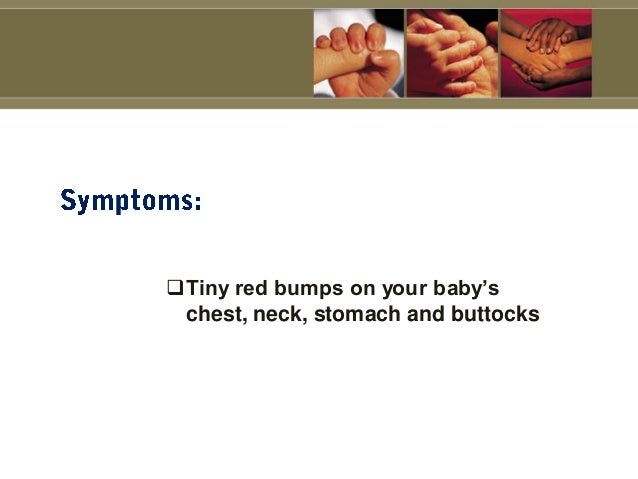Most Common Infant Skin Problems