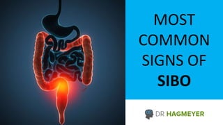 MOST
COMMON
SIGNS OF
SIBO
 