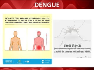DENGUE
 