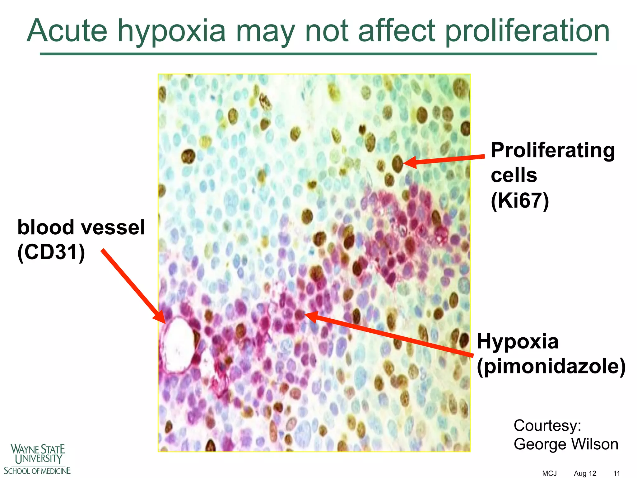 Acute hypoxia may not affect proliferation

Proliferating
cells
(Ki67)
blood vessel
(CD31)

Hypoxia
(pimonidazole)
Courtesy:
George Wilson
MCJ

Aug 12

11

 