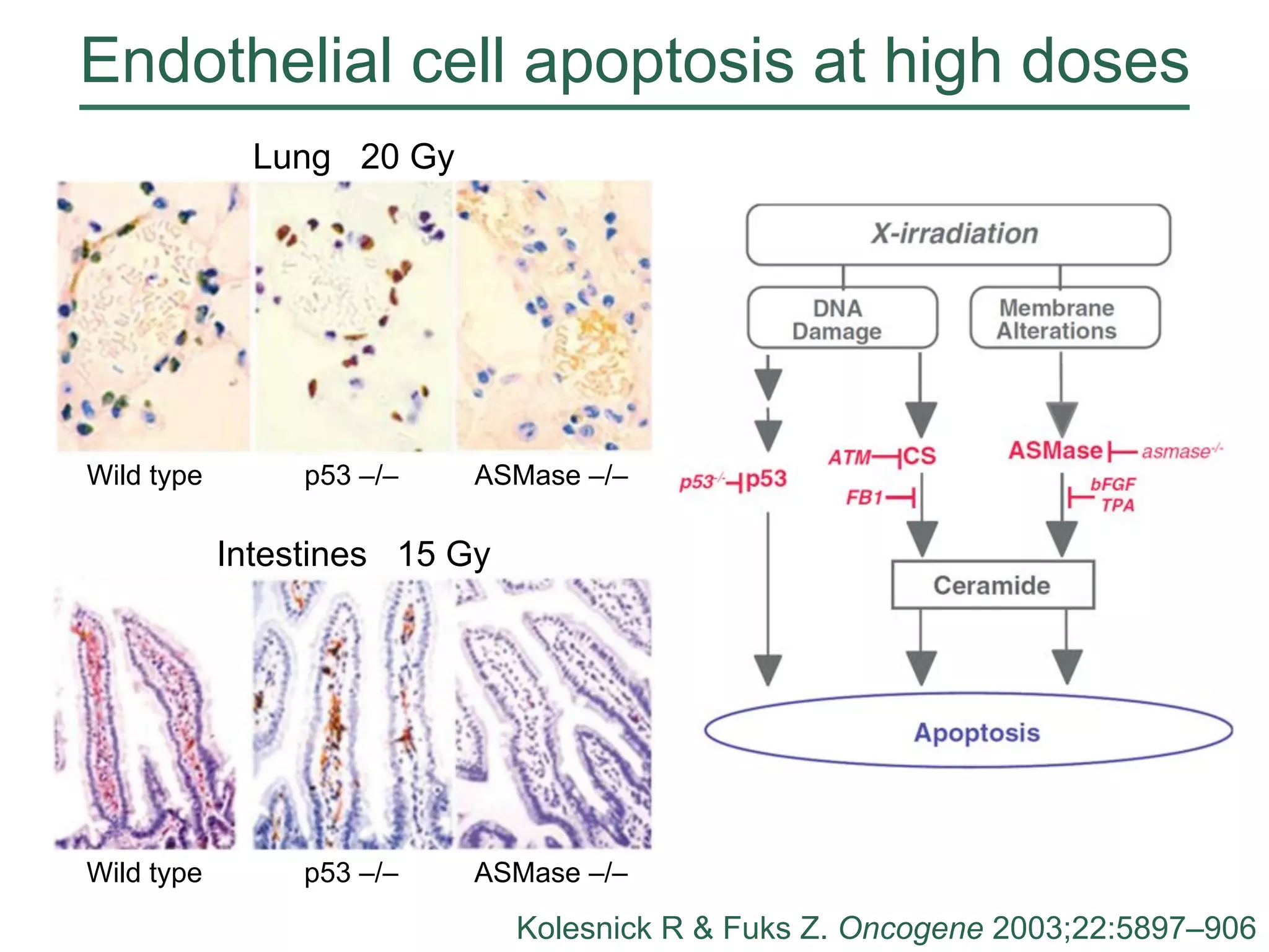 Endothelial cell apoptosis at high doses
Lung 20 Gy

Wild type

p53 –/–

ASMase –/–

Intestines 15 Gy

Wild type

p53 –/–

ASMase –/–

Kolesnick R & Fuks Z. Oncogene 2003;22:5897–906
MCJ
24
Aug 12

 