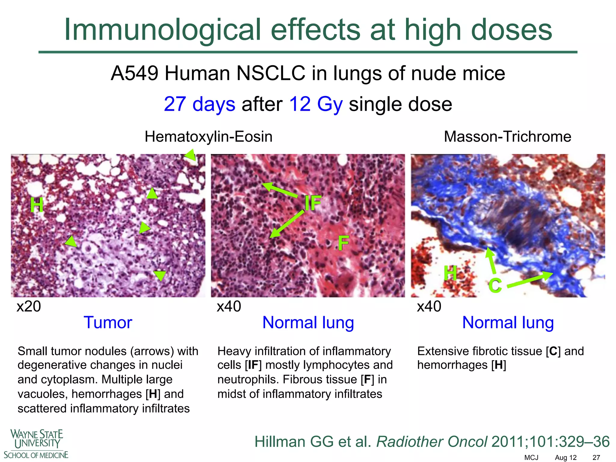 Immunological effects at high doses
A549 Human NSCLC in lungs of nude mice
27 days after 12 Gy single dose
Hematoxylin-Eosin

Masson-Trichrome

IF

H

F
H
x20

Tumor

Small tumor nodules (arrows) with
degenerative changes in nuclei
and cytoplasm. Multiple large
vacuoles, hemorrhages [H] and
scattered inflammatory infiltrates

x40

Normal lung

Heavy infiltration of inflammatory
cells [IF] mostly lymphocytes and
neutrophils. Fibrous tissue [F] in
midst of inflammatory infiltrates

x40

C
Normal lung

Extensive fibrotic tissue [C] and
hemorrhages [H]

Hillman GG et al. Radiother Oncol 2011;101:329–36
MCJ

Aug 12

27

 