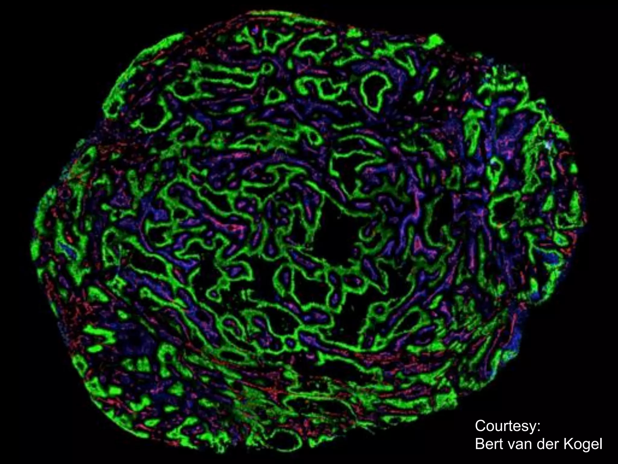 Courtesy:
Bert van der Kogel

 