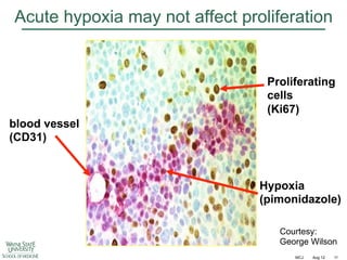 Acute hypoxia may not affect proliferation

Proliferating
cells
(Ki67)
blood vessel
(CD31)

Hypoxia
(pimonidazole)
Courtesy:
George Wilson
MCJ

Aug 12

11

 