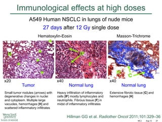 Immunological effects at high doses
A549 Human NSCLC in lungs of nude mice
27 days after 12 Gy single dose
Hematoxylin-Eosin

Masson-Trichrome

IF

H

F
H
x20

Tumor

Small tumor nodules (arrows) with
degenerative changes in nuclei
and cytoplasm. Multiple large
vacuoles, hemorrhages [H] and
scattered inflammatory infiltrates

x40

Normal lung

Heavy infiltration of inflammatory
cells [IF] mostly lymphocytes and
neutrophils. Fibrous tissue [F] in
midst of inflammatory infiltrates

x40

C
Normal lung

Extensive fibrotic tissue [C] and
hemorrhages [H]

Hillman GG et al. Radiother Oncol 2011;101:329–36
MCJ

Aug 12

27

 