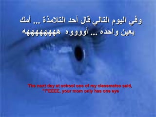 وفي اليوم التالي قال أحد التلامذة  ...  أمك  بعين واحده  ...  أووووه   ههههههههه The next day at school one of my classmates said, "EEEE, your mom only has one eye!"  