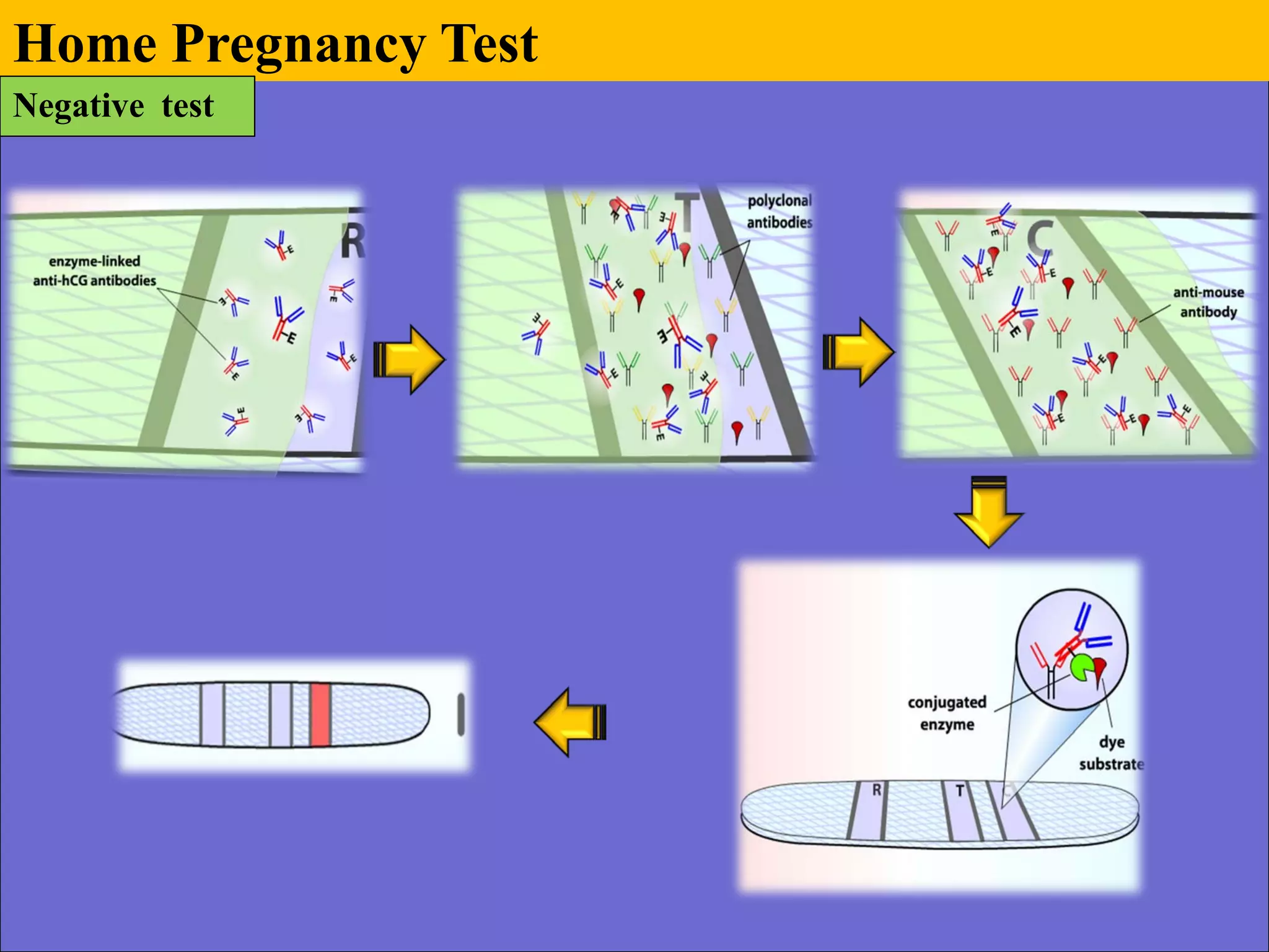 Home Pregnancy Test
Negative test
 